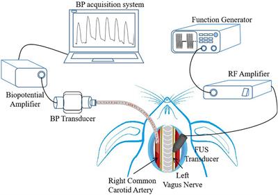 Blood Pressure Modulation With Low-Intensity Focused Ultrasound Stimulation to the Vagus Nerve: A Pilot Animal Study